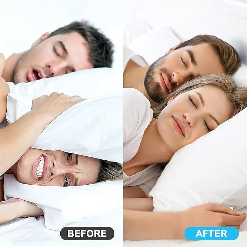Magnetic nasal dilator before and after snoring couple sleeping